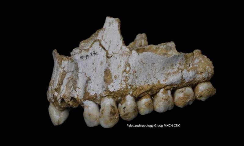 El Sidron upper jaw: a dental calculus deposit is visible on the rear molar (right) of this Neandertal. This individual was eating poplar, a source of aspirin, and had also consumed moulded vegetation including Penicillium fungus, source of a natural antibiotic. Credit: Paleoanthropology Group MNCN-CSIC  Read more at: https://phys.org/news/2017-03-dental-plaque-dna-neandertals-aspirin.html#jCp
